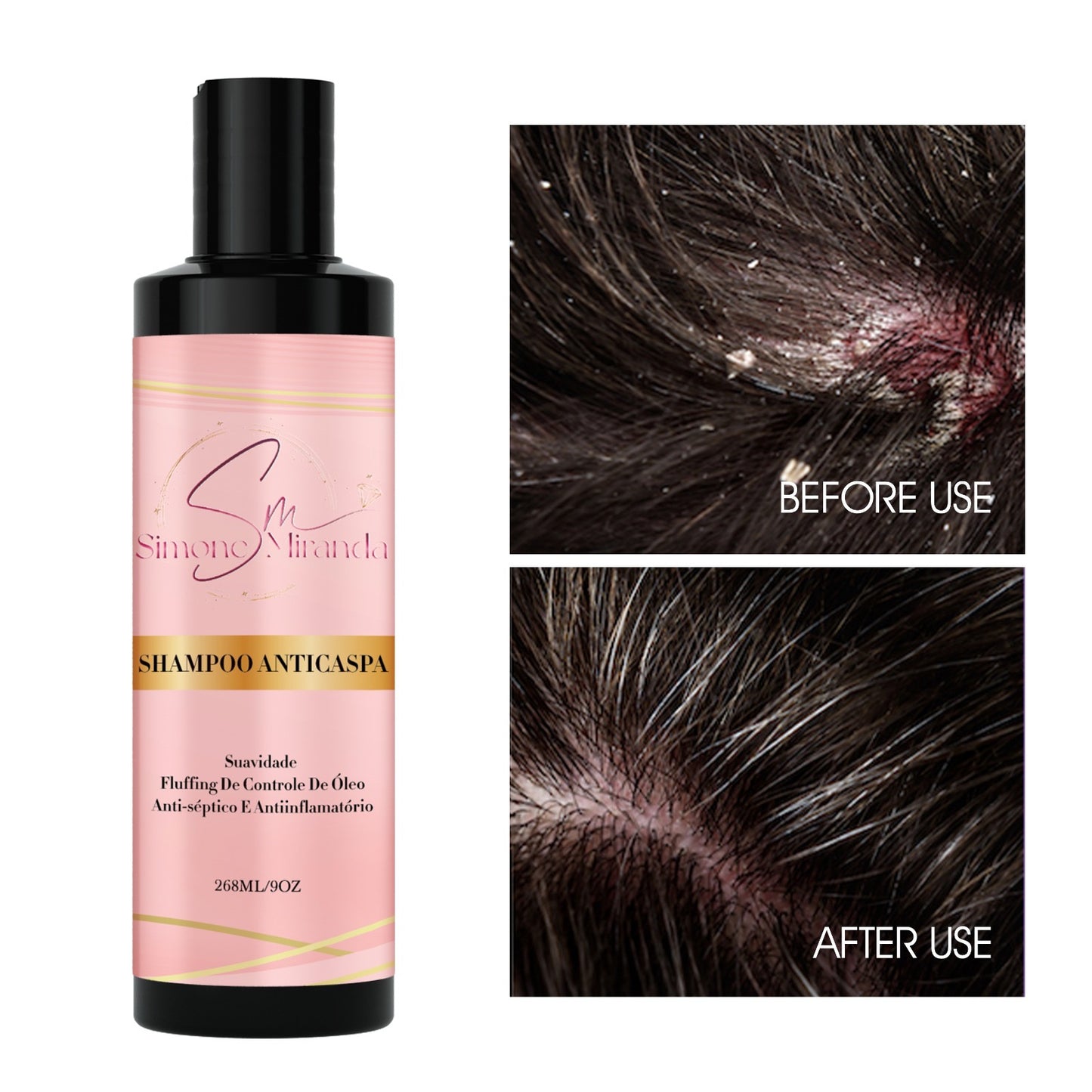 Kit Shampoo + Condicionador Anti-Caspa